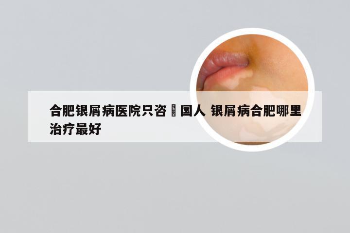 合肥银屑病医院只咨詢国人 银屑病合肥哪里治疗最好