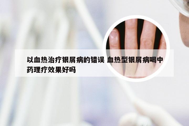 以血热治疗银屑病的错误 血热型银屑病喝中药理疗效果好吗