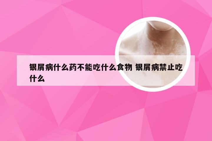 银屑病什么药不能吃什么食物 银屑病禁止吃什么