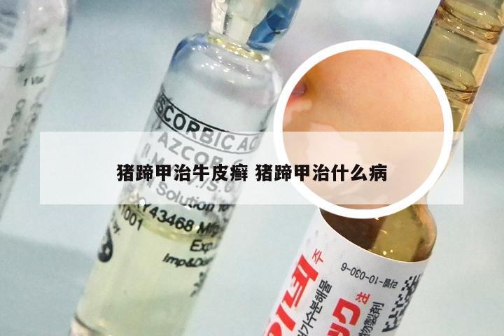 猪蹄甲治牛皮癣 猪蹄甲治什么病