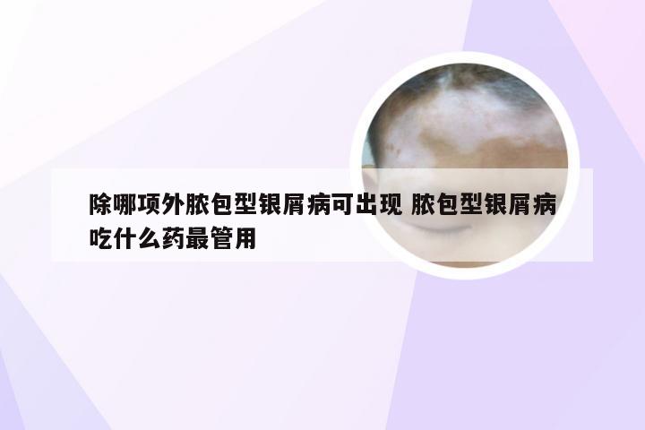 除哪项外脓包型银屑病可出现 脓包型银屑病吃什么药最管用