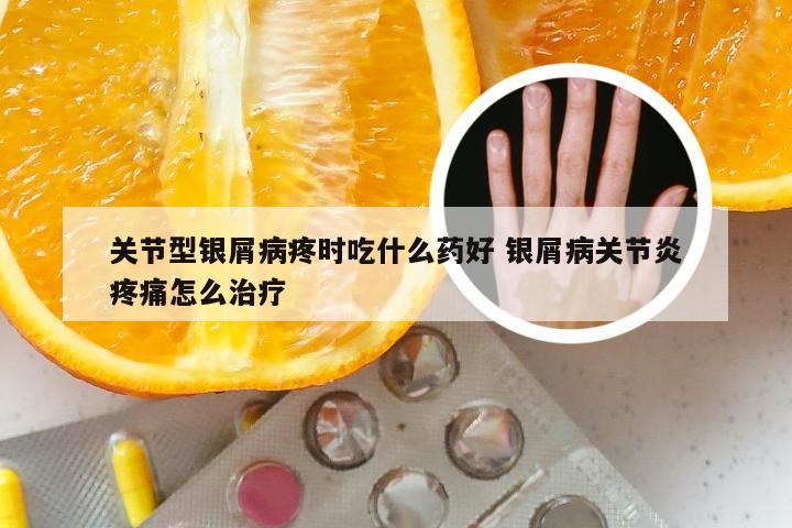 关节型银屑病疼时吃什么药好 银屑病关节炎疼痛怎么治疗