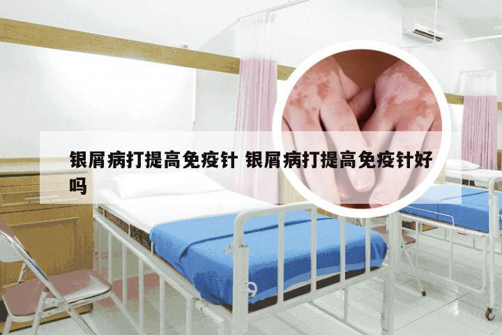 银屑病打提高免疫针 银屑病打提高免疫针好吗