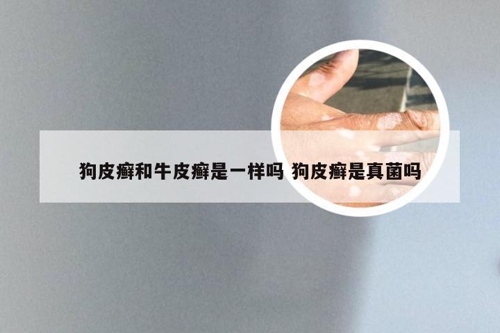 狗皮癣和牛皮癣是一样吗 狗皮癣是真菌吗