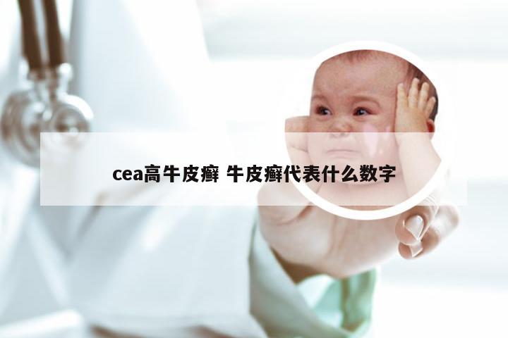 cea高牛皮癣 牛皮癣代表什么数字