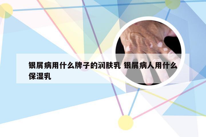 银屑病用什么牌子的润肤乳 银屑病人用什么保湿乳