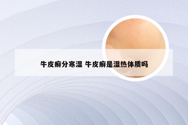牛皮癣分寒湿 牛皮癣是湿热体质吗