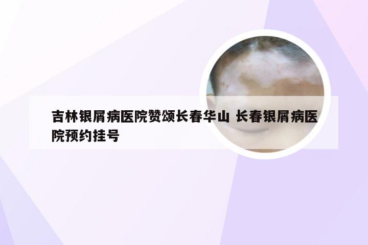 吉林银屑病医院赞颂长春华山 长春银屑病医院预约挂号