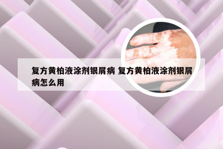 复方黄柏液涂剂银屑病 复方黄柏液涂剂银屑病怎么用