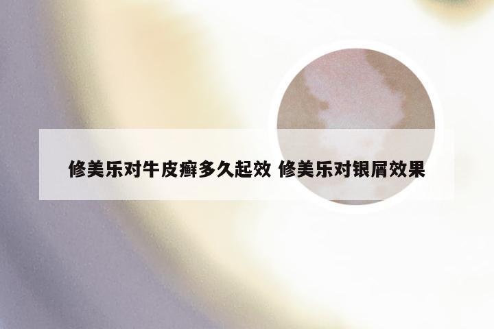修美乐对牛皮癣多久起效 修美乐对银屑效果