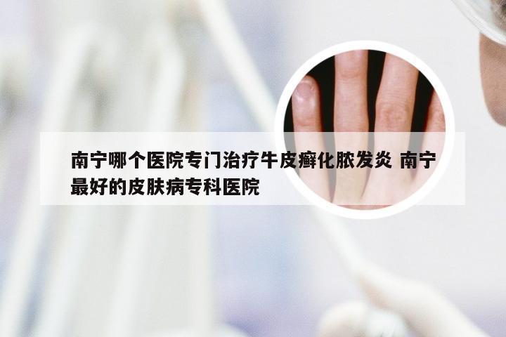 南宁哪个医院专门治疗牛皮癣化脓发炎 南宁最好的皮肤病专科医院