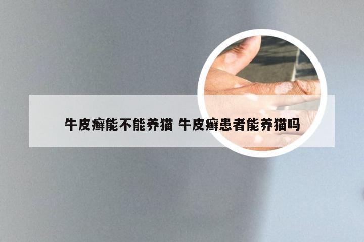 牛皮癣能不能养猫 牛皮癣患者能养猫吗