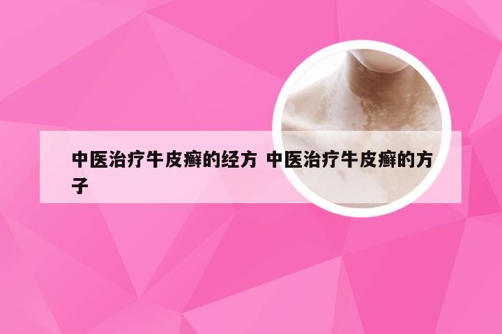 中医治疗牛皮癣的经方 中医治疗牛皮癣的方子