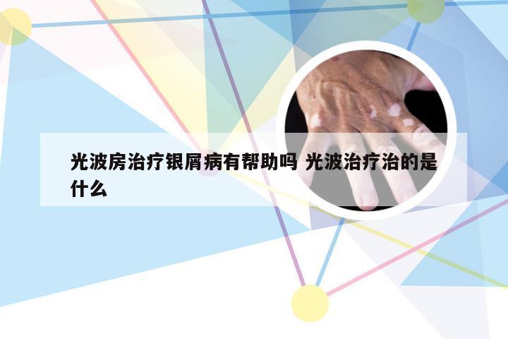 光波房治疗银屑病有帮助吗 光波治疗治的是什么