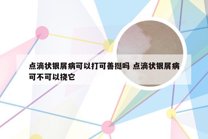 点滴状银屑病可以打可善挺吗 点滴状银屑病可不可以挠它