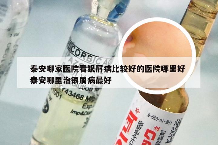 泰安哪家医院看银屑病比较好的医院哪里好 泰安哪里治银屑病最好