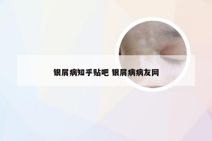 银屑病知乎贴吧 银屑病病友网