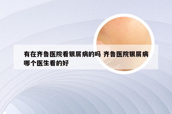 有在齐鲁医院看银屑病的吗 齐鲁医院银屑病哪个医生看的好