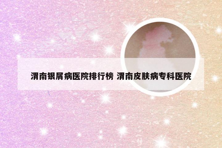 渭南银屑病医院排行榜 渭南皮肤病专科医院