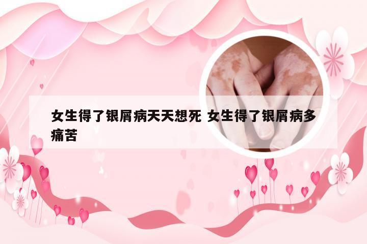 女生得了银屑病天天想死 女生得了银屑病多痛苦