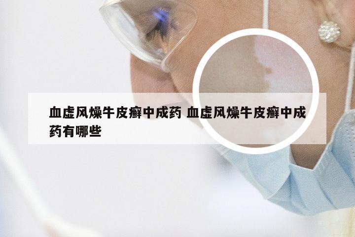 血虚风燥牛皮癣中成药 血虚风燥牛皮癣中成药有哪些