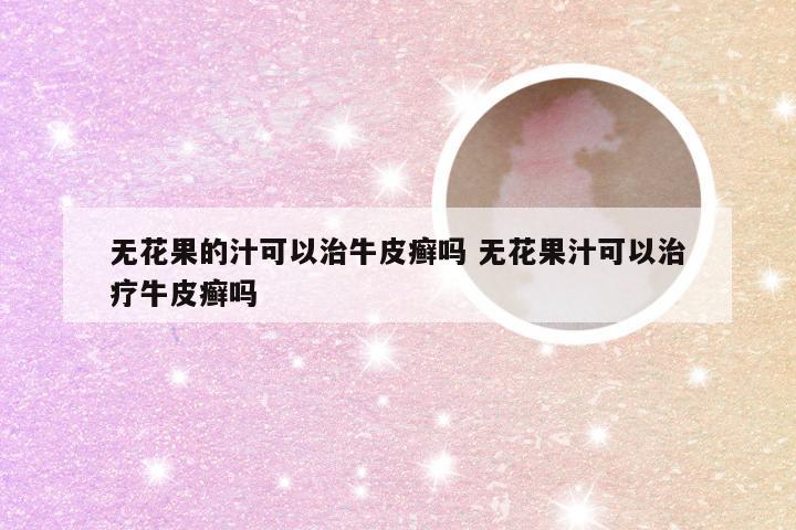 无花果的汁可以治牛皮癣吗 无花果汁可以治疗牛皮癣吗