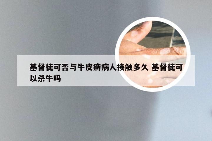 基督徒可否与牛皮癣病人接触多久 基督徒可以杀牛吗