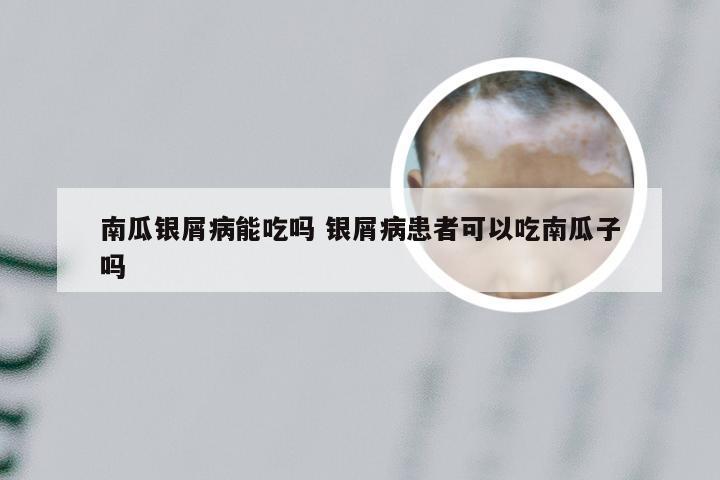 南瓜银屑病能吃吗 银屑病患者可以吃南瓜子吗