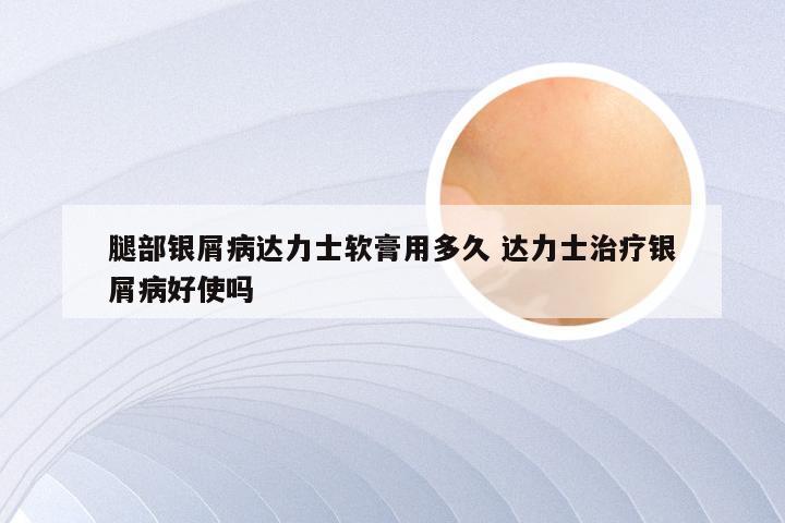 腿部银屑病达力士软膏用多久 达力士治疗银屑病好使吗