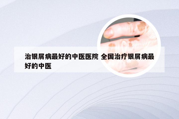 治银屑病最好的中医医院 全国治疗银屑病最好的中医