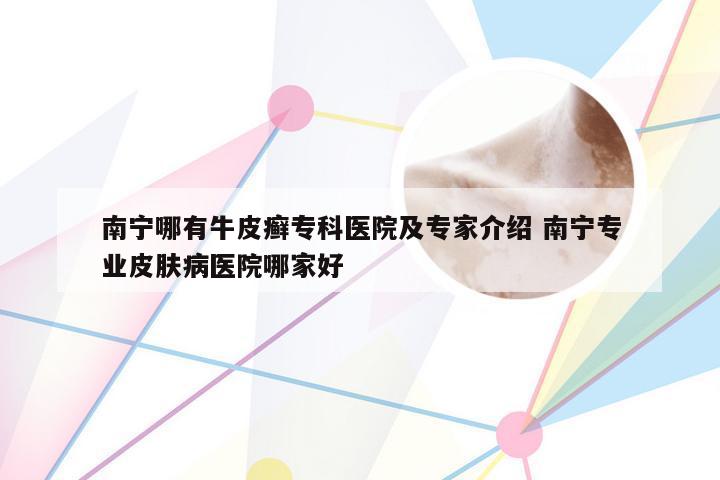 南宁哪有牛皮癣专科医院及专家介绍 南宁专业皮肤病医院哪家好