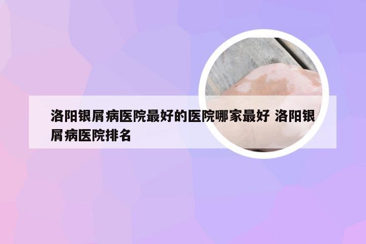 洛阳银屑病医院最好的医院哪家最好 洛阳银屑病医院排名