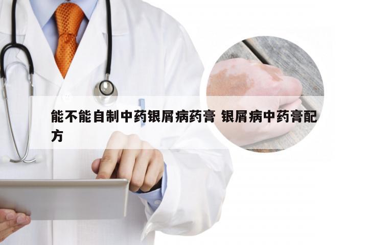 能不能自制中药银屑病药膏 银屑病中药膏配方