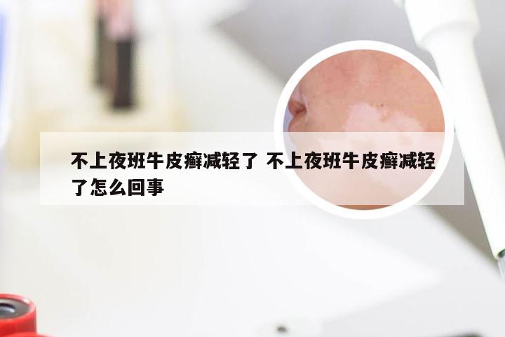 不上夜班牛皮癣减轻了 不上夜班牛皮癣减轻了怎么回事