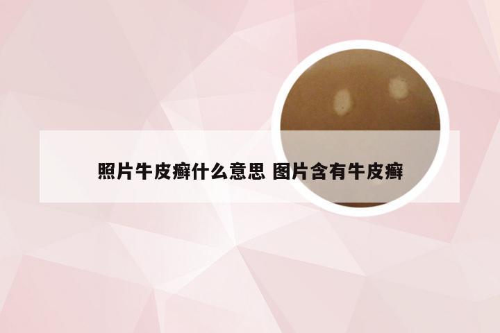 照片牛皮癣什么意思 图片含有牛皮癣