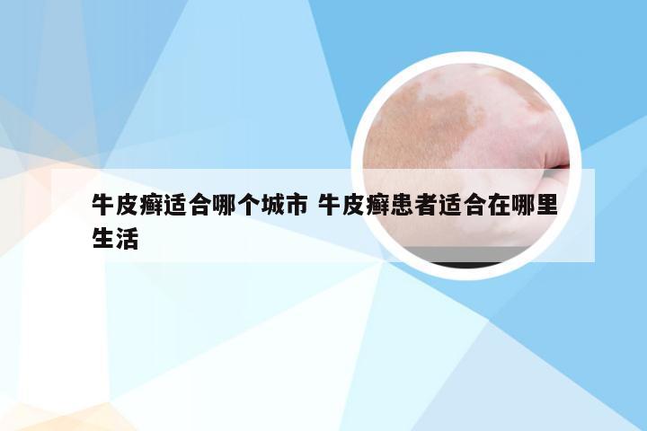 牛皮癣适合哪个城市 牛皮癣患者适合在哪里生活