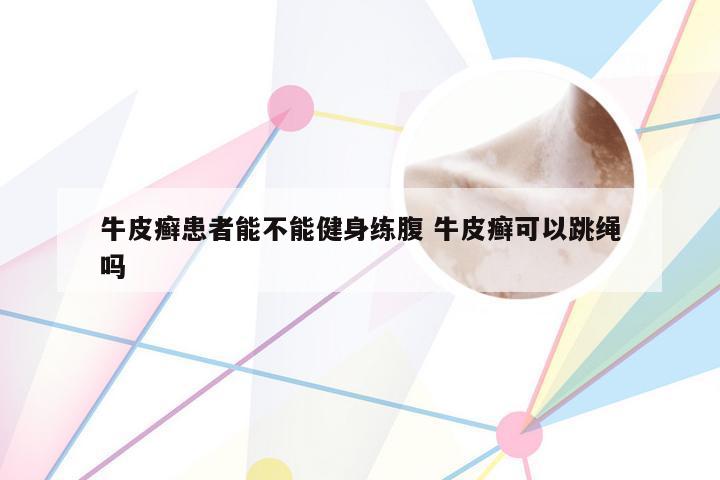 牛皮癣患者能不能健身练腹 牛皮癣可以跳绳吗