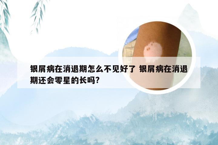 银屑病在消退期怎么不见好了 银屑病在消退期还会零星的长吗?