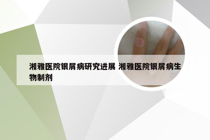 湘雅医院银屑病研究进展 湘雅医院银屑病生物制剂