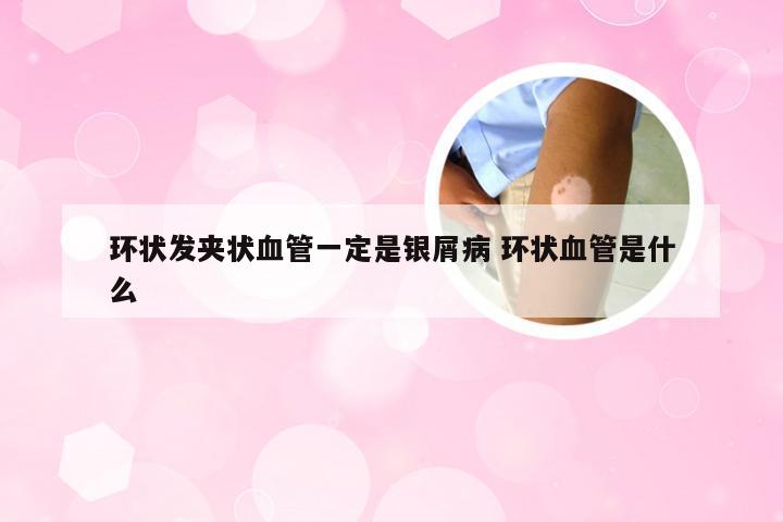 环状发夹状血管一定是银屑病 环状血管是什么