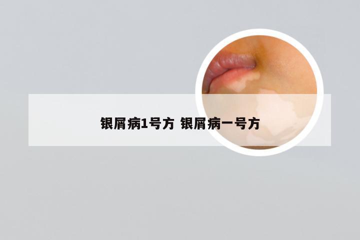 银屑病1号方 银屑病一号方