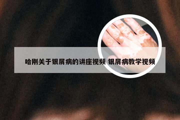 哈刚关于银屑病的讲座视频 银屑病教学视频