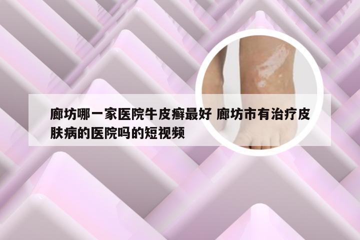 廊坊哪一家医院牛皮癣最好 廊坊市有治疗皮肤病的医院吗的短视频