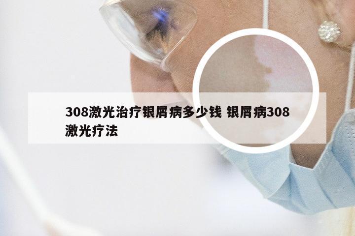 308激光治疗银屑病多少钱 银屑病308激光疗法