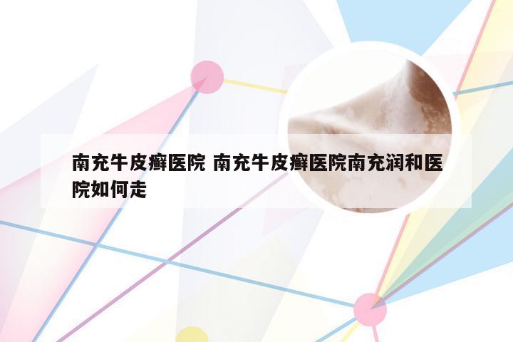 南充牛皮癣医院 南充牛皮癣医院南充润和医院如何走