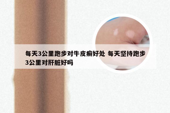 每天3公里跑步对牛皮癣好处 每天坚持跑步3公里对肝脏好吗