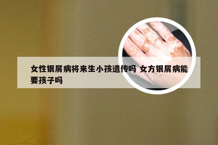 女性银屑病将来生小孩遗传吗 女方银屑病能要孩子吗