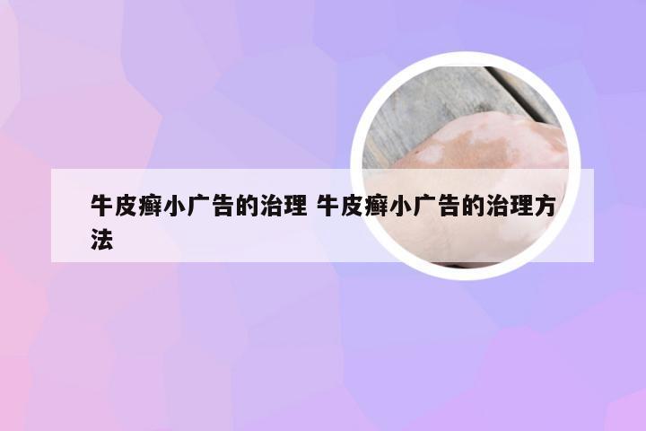 牛皮癣小广告的治理 牛皮癣小广告的治理方法
