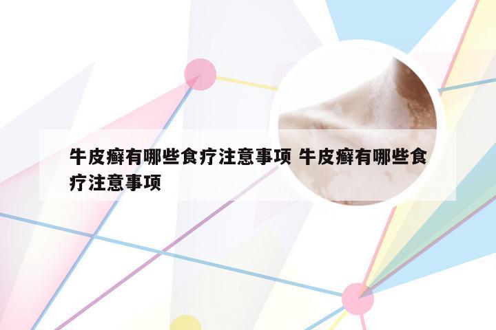 牛皮癣有哪些食疗注意事项 牛皮癣有哪些食疗注意事项
