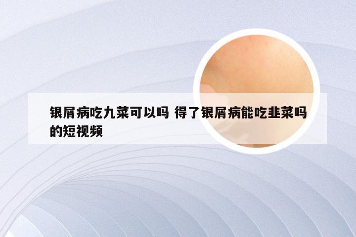 银屑病吃九菜可以吗 得了银屑病能吃韭菜吗的短视频